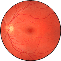 Fundus photography image of an eye